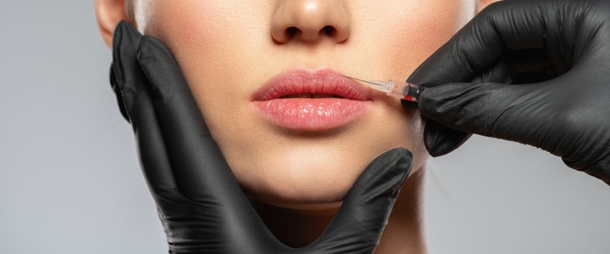 Dudak Kaldırma (Lip Lift): Daha Genç ve Çekici Dudaklar İçin Cerrahi Teknikler